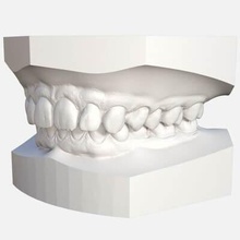 kieferorthopädische studienmodelle druckfertige 3d Modell digitale orthodontische Modelle für virtuelle abo bases3shape appliance designer 2017 & keyshot pro 3d print model - Mito3D