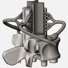 simplificado espinal cable cruzar impresión Listo 3d modelo rachidsw 3d print model - Mito3D