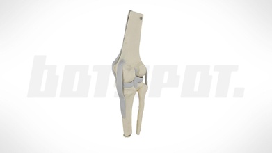 botscan momentum knee joint çiğ botspot 3d model botspot3d ad21e48 3d print model - Mito3D