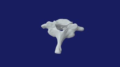 c7 - cervical vertebra download free 3d model dr alex cheroske aquaman27 e0bc4d3 3d print model - Mito3D
