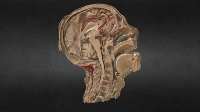 corte sagital Cabeza cabeça Comprar realeza livre 3d modelo uach gonzalo Tiznado 6909f7e pont anatomia cérebro corpus cerebral oz tronco cuerpo caloso hipotálamo 3d print model - Mito3D