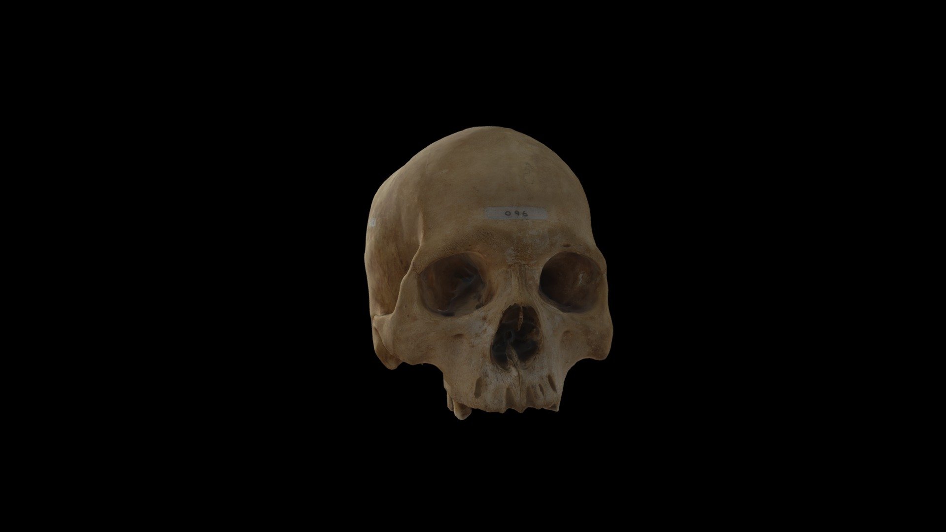 cr neo humano homo sapiens - modelo 3d shiro alegomez 41338e6 obtenido por fotogrametr perteneciente las colecciones osteolog faculdade biolog universidade de habana autor alejandro jos g mez-garc 3D print model - Mito3D