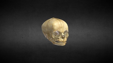 cr neo nacido recién cráneo comprar realeza gratis 3d modelo anatomía humano gonzalo tiznado mandíbula craneo maxilar superior hueso 3dskull fuentes agua potable mandibula 3d print model - Mito3D