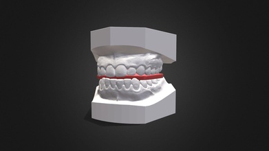 dentale modello Costruzioni mordere acquistare royalty gratuito 3d Davide specchi davidespecchi 2ebafd0 3d print model - Mito3D