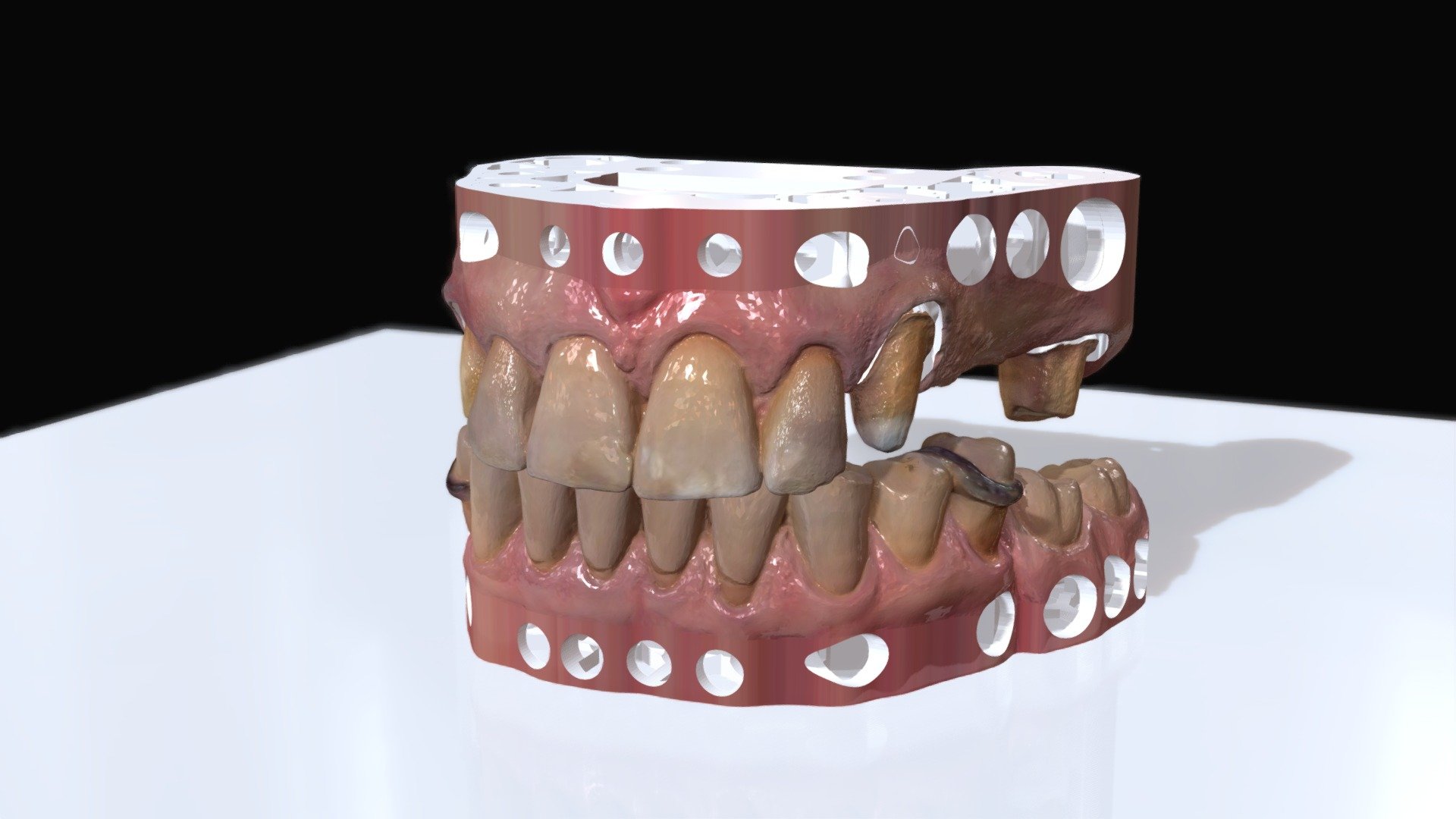 dentale scansione protesi Scarica gratuito 3d modello anknv 52736c1 3D print model - Mito3D