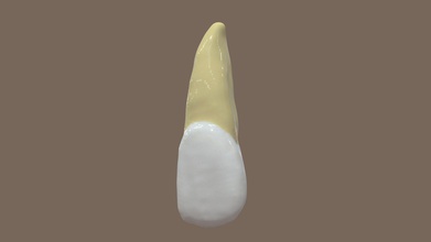 incisivo centrale maxilar dc - scarica gratis 3d modello dcoral43 7057924 diente 3d print model - Mito3D