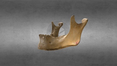 homme bulle mandibule acheter royalties libre 3d modèle anatomie Humain gonzalo tiznado OS craneo hueso crâne 3d print model - Mito3D