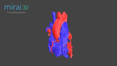 modelo cardiovascolare adulto 3d modello mirai3d c8e73b9 3d print model - Mito3D