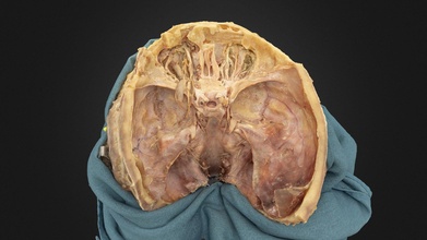 orbit cranial cavity - 3d model ubc medicine educational media ubcmedvid caf1e5f 3d print model - Mito3D