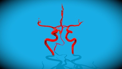 hartnäckig Primitive Trigeminus Arterie mri stl download frei 3d Modell Stuhl Digital Anatomie 49b5514 3d print model - Mito3D
