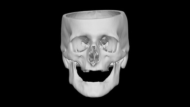 cráneo masculino 59yo descargar gratis 3d modelo terrie simmons ehrhardt terrielsimmons 89fc9e2 3d print model - Mito3D