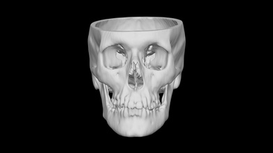 skull male 61yo - download free 3d model terrie simmons-ehrhardt terrielsimmons de154ce 3d print model - Mito3D