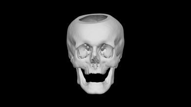 skull male 70yo - download free 3d model terrie simmons-ehrhardt terrielsimmons 0407a80 3d print model - Mito3D