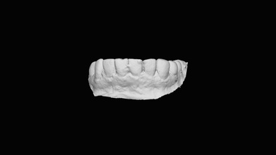 teeth - download free 3d model thunk3dscanner 8c548a6 3d print model - Mito3D