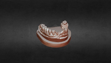 dentes modelo baixar livre 3d thunk3dscanner fd91eb5 3d print model - Mito3D