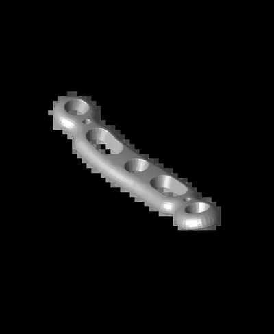 clavícula eixo osso placa stl 3d by ortopédico ossos on 3d print model - Mito3D