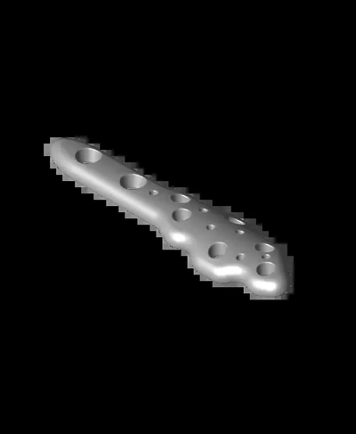 distal fibulastl - 3d by orthopaedic bones on thangs 3d print model - Mito3D