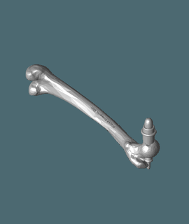 femore riflesso martello ortopedico ossatura 3d print model - Mito3D