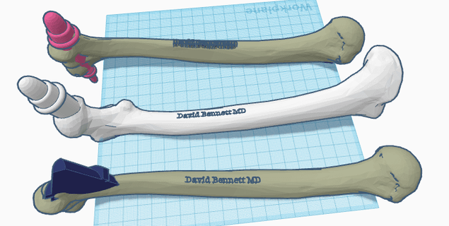 húmero hueso reflejo martillosstl ortopédico huesos 3d print model - Mito3D