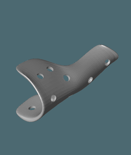 leftholsstl orthopädisch Knochen 3d print model - Mito3D