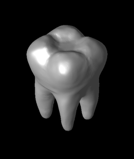 missing tooth 3d model thatguyscott thangs 3d print model - Mito3D