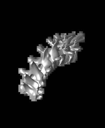 pjk cervicotorácico junção bennett render 3d by ortopédico ossos on 3d print model - Mito3D