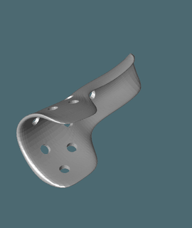 rightholsstl - orthopaedic bones 3d print model - Mito3D
