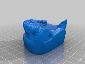 cast 101 d'autres os les prothèses dentaires dents 3d print model - Mito3D