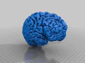 cerveau vivant dans la partie droite d'autres médical l'irm 3d print model - Mito3D