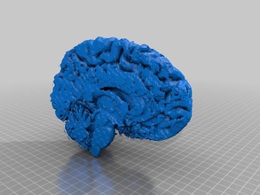 living brain left part other medical 3d print model - Mito3D