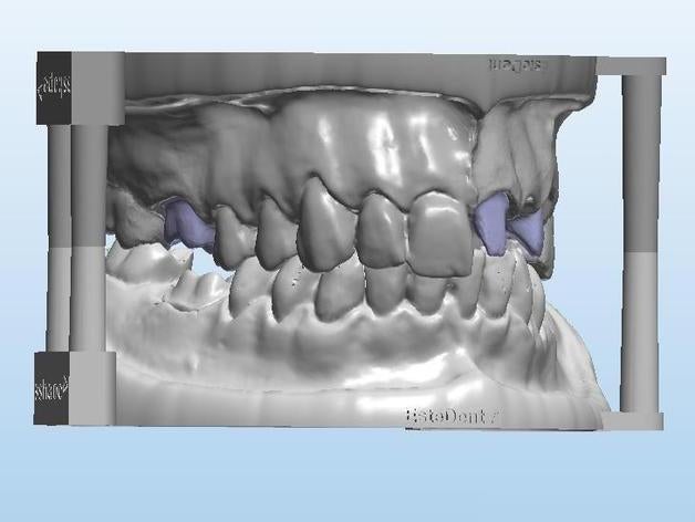 dental model+antagonist+3 teeth creatures denture 3D print model - Mito3D