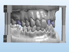 dental model+antagonist+3 teeth creatures denture