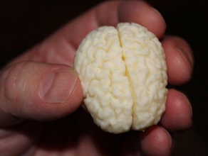 think biology anatomy brain mri 3d print model - Mito3D
