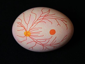 egg-bot oculaire du fond de l'oeil d'autres eggbot l'œil l'ophtalmologie la rétine 3d print model - Mito3D