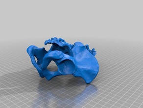 colgante de la hernia discal que lo sufren joyería 3d print model - Mito3D