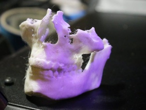 dicom stl geomagics crâne les analyses des répliques ct dentaire 3d print model - Mito3D