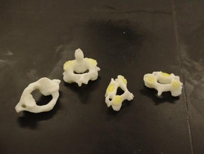 human cervical vertebrae c1-c4 biology anatomy bones spine neck 3d print model - Mito3D