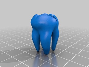 çürük diş diğer molar ağız 3d print model - Mito3D