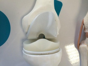 knee prosthesis model biology biomedical bone isifc learning makerbotdigitizer prothesis scan 3d print model - Mito3D
