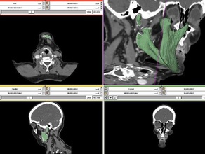 mandible bone other bones ct data human skull jaw makeaperson 3d print model - Mito3D