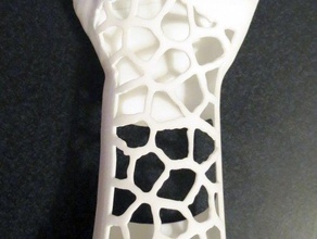 hollies arm v2 other anthromod prosthesis robohand 3d print model - Mito3D
