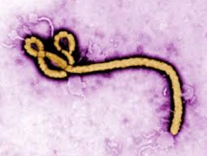 virus ebola biologia l'ebola 3d print model - Mito3D