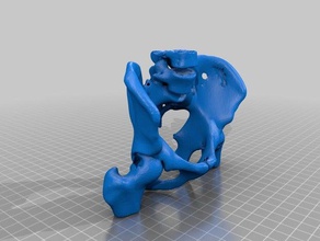my pelvis 3d printing 3d print model - Mito3D