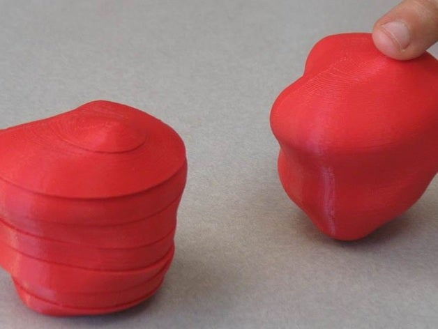 tumor mri slices math integration 3D print model - Mito3D