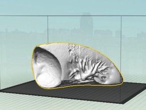 left lung 1 people 3d print model - Mito3D
