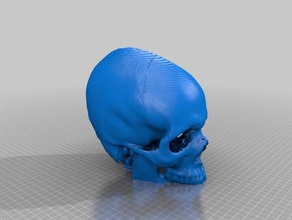 tomografía computarizada hueso cabeza cráneo humano el 3d print model - Mito3D