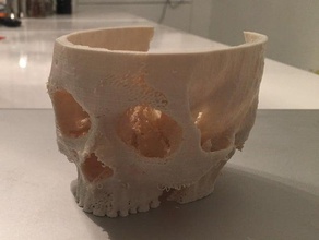 live ct data my wifes skull reconstructed biology medical 3d print model - Mito3D