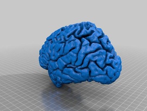 brain 24-year-old human female biology gray matter medical mri white 3d print model - Mito3D
