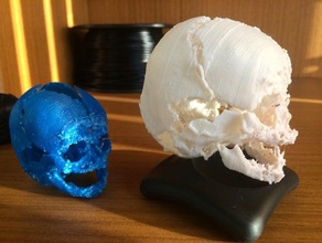 recién nacido cráneo biología birthdefects 3d print model - Mito3D