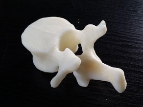 lumbar vertebrae sacrum easy printable format biology 3d print model - Mito3D